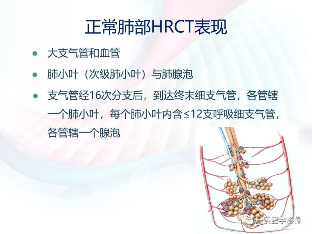 影像PPT - 【PPT】肺弥漫性病变HRCT表现-8