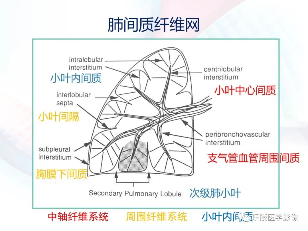 影像PPT - 【PPT】肺弥漫性病变HRCT表现-14