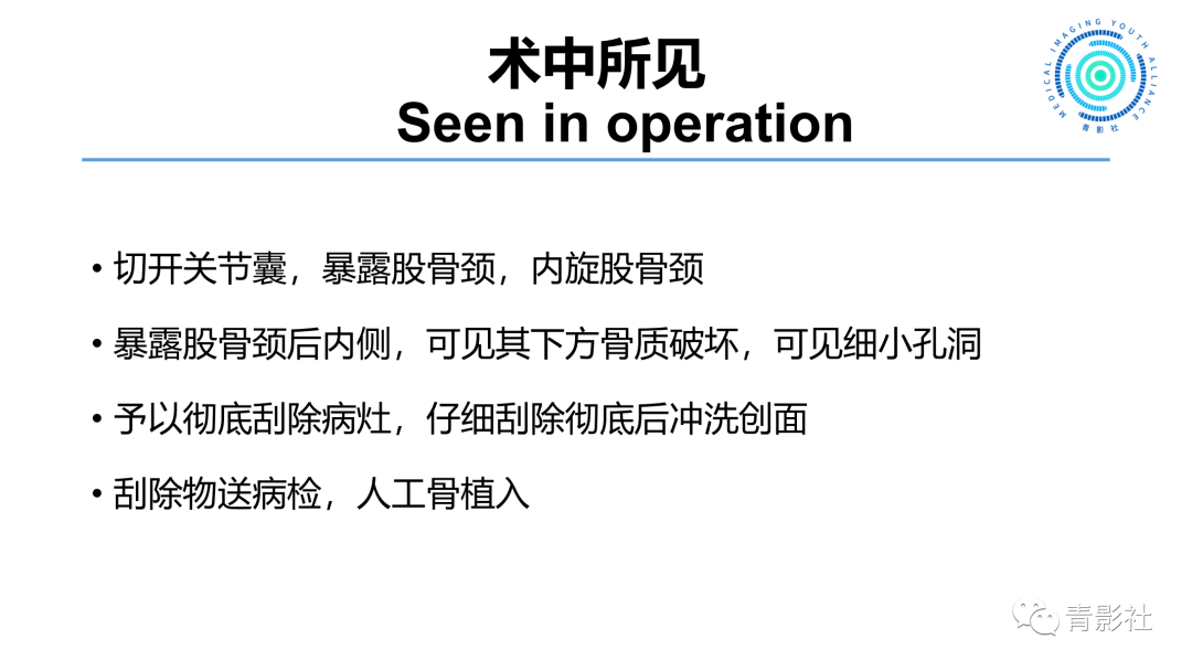 影像PPT - 【病例】股骨骨样骨瘤1例X线CT及MR影像-9