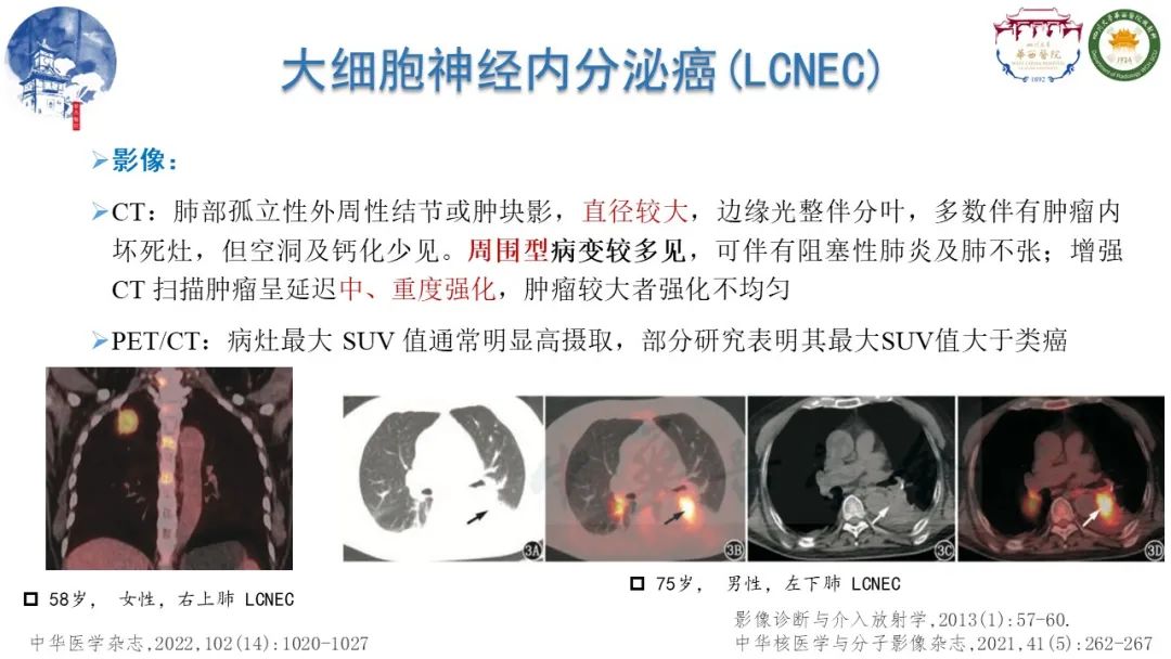 影像PPT - 【病例】纵隔大细胞神经内分泌癌1例CT影像-10
