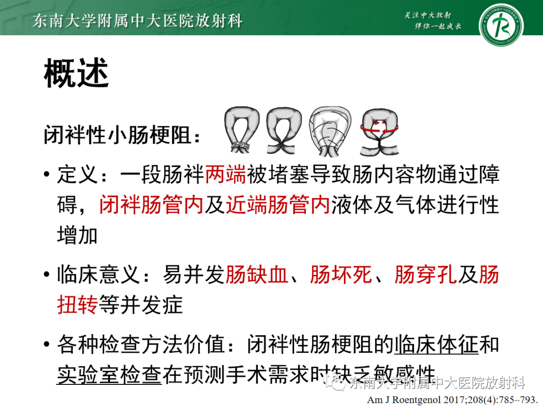 影像PPT - 【PPT】闭袢性小肠梗阻：CT征象评估的价值-7