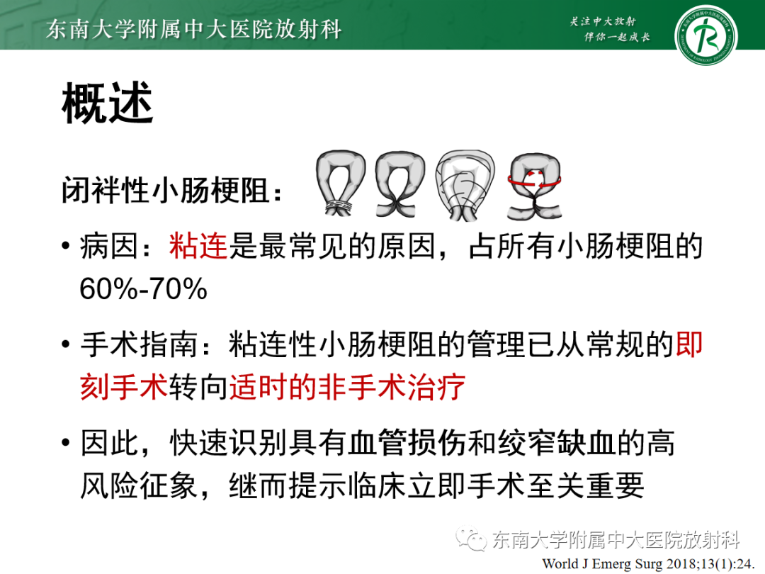 影像PPT - 【PPT】闭袢性小肠梗阻：CT征象评估的价值-8