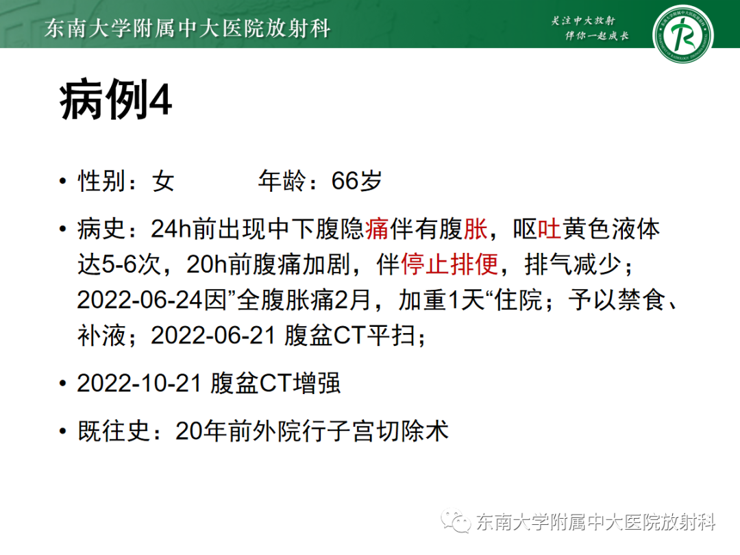 影像PPT - 【PPT】闭袢性小肠梗阻：CT征象评估的价值-20