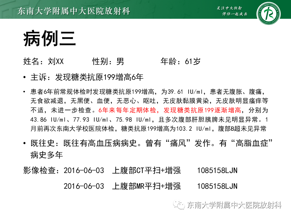 影像PPT - 【PPT】胰腺神经内分泌肿瘤-28 影像PPT - 【PPT】胰腺神经内分泌肿瘤-28