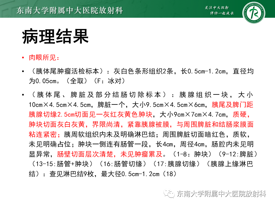 影像PPT - 【PPT】胰腺神经内分泌肿瘤-32 影像PPT - 【PPT】胰腺神经内分泌肿瘤-32