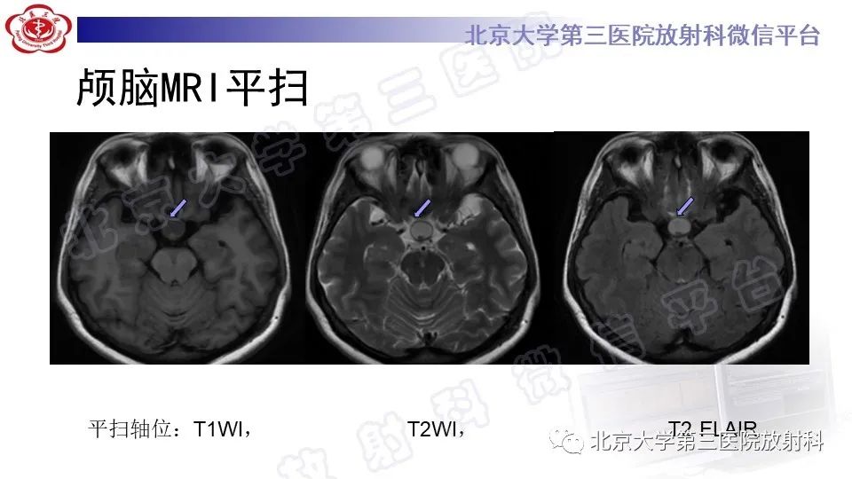 影像PPT - -4