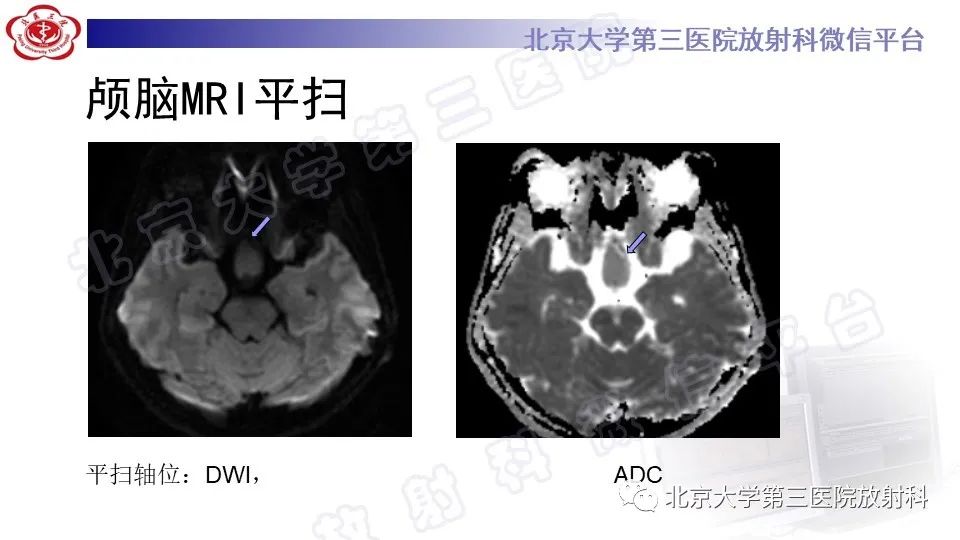 影像PPT - -5