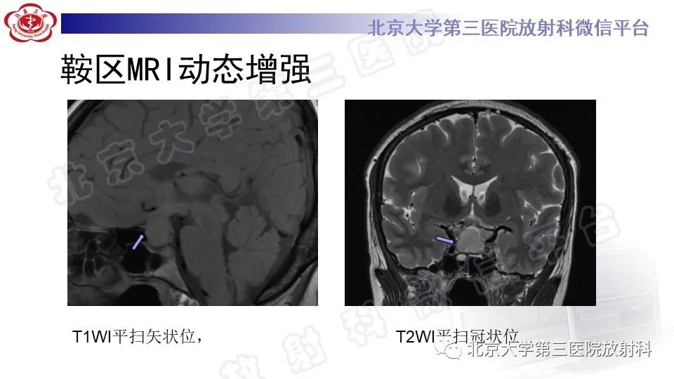 影像PPT - -6