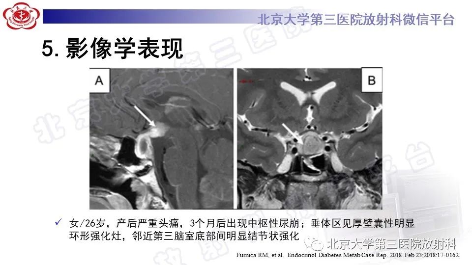 影像PPT - -19