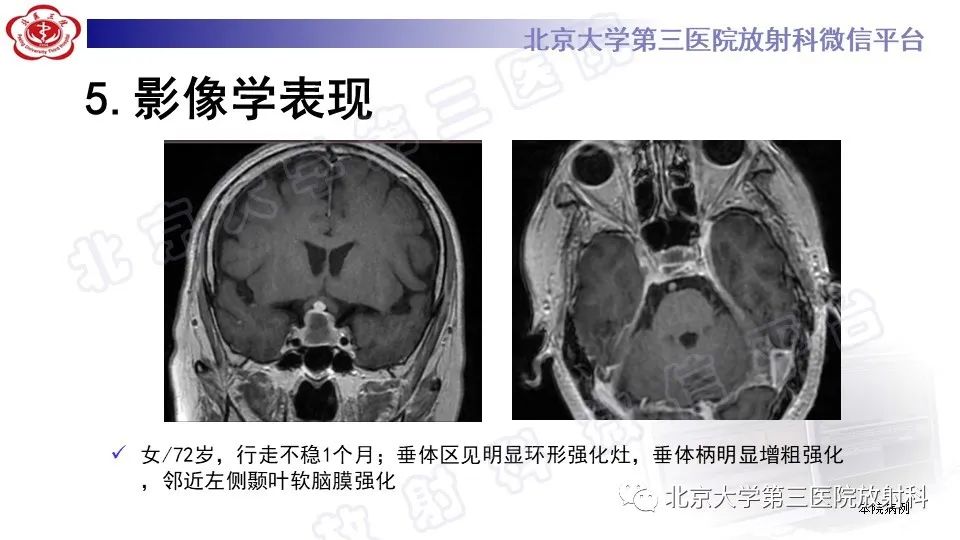 影像PPT - -21