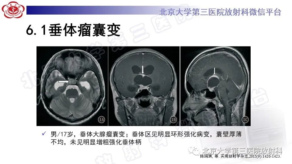 影像PPT - -24