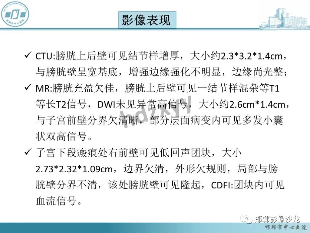 影像PPT - 【PPT】膀胱子宫内膜异位症-11 影像PPT - 【PPT】膀胱子宫内膜异位症-11