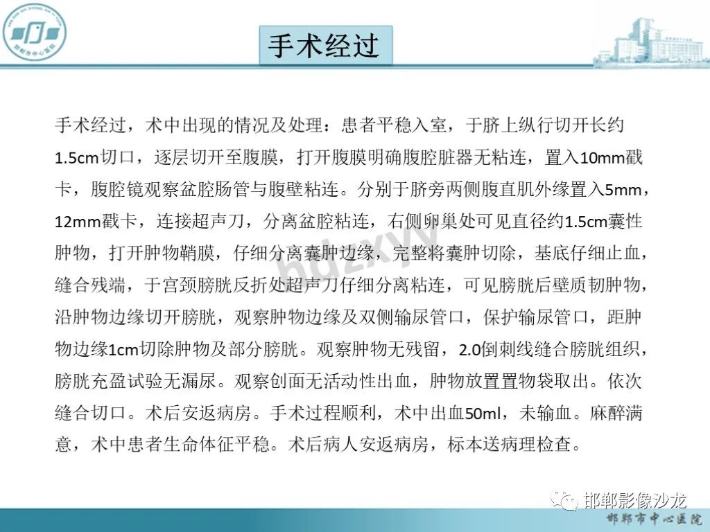 影像PPT - 【PPT】膀胱子宫内膜异位症-12 影像PPT - 【PPT】膀胱子宫内膜异位症-12