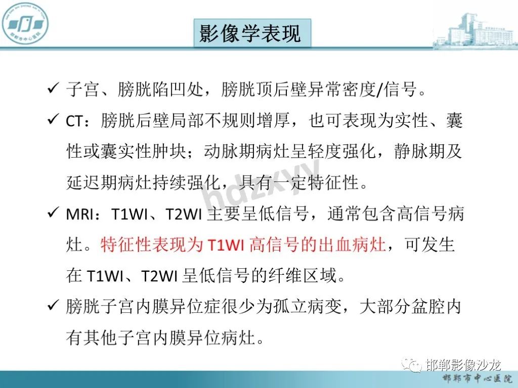 影像PPT - 【PPT】膀胱子宫内膜异位症-18 影像PPT - 【PPT】膀胱子宫内膜异位症-18