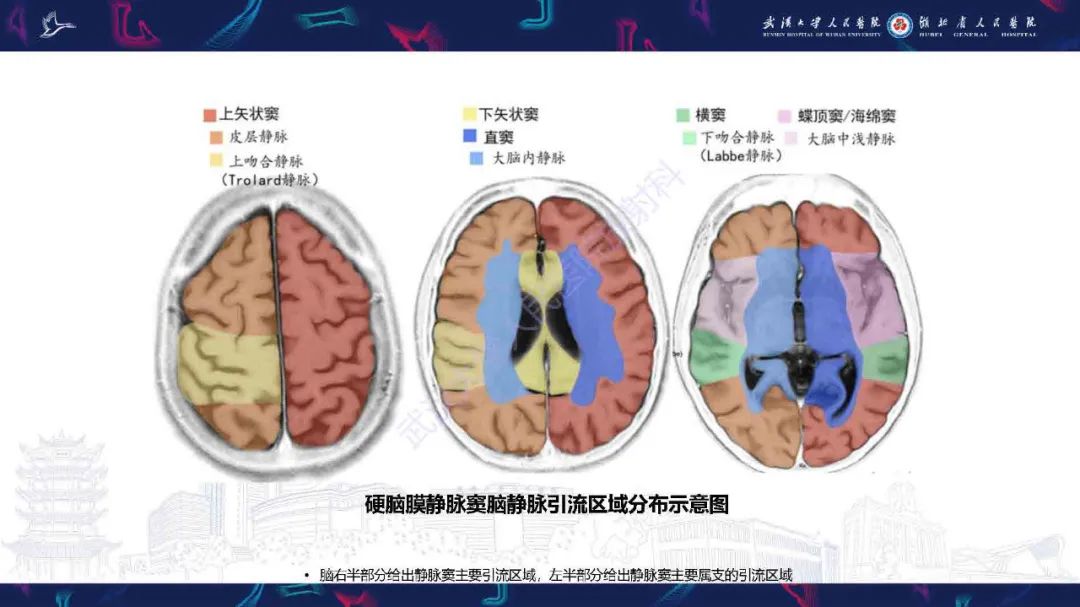 影像PPT - 【PPT】儿童脑静脉病变影像诊断-11