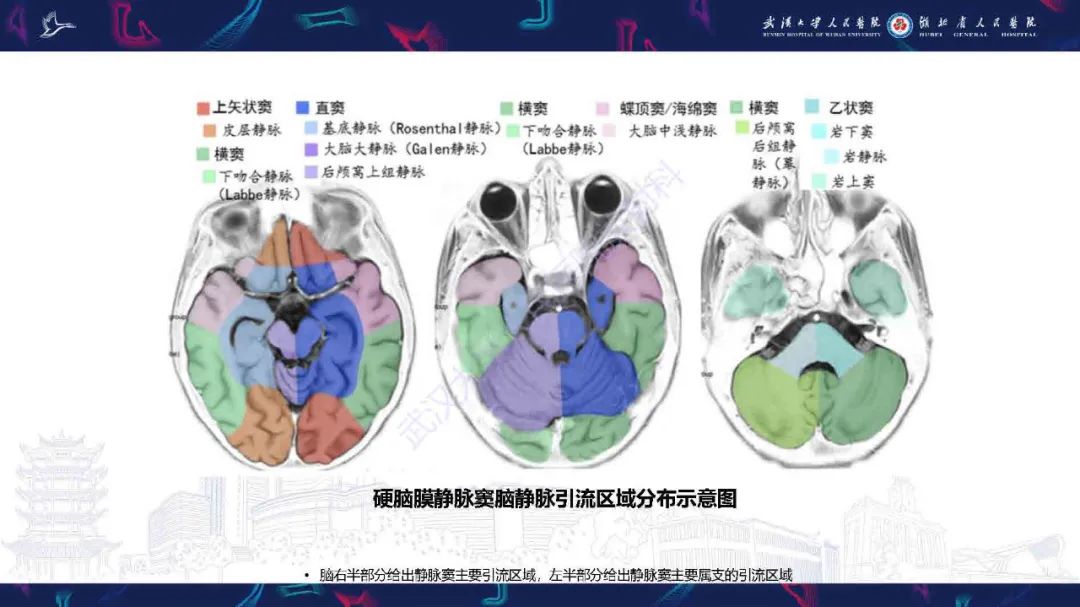 影像PPT - 【PPT】儿童脑静脉病变影像诊断-12