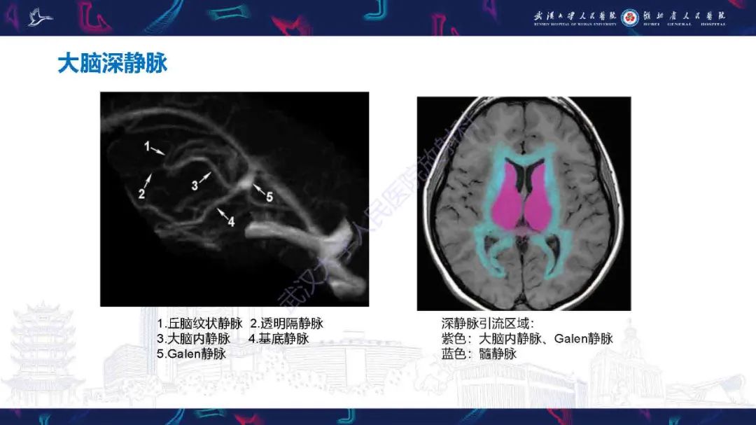 影像PPT - 【PPT】儿童脑静脉病变影像诊断-13