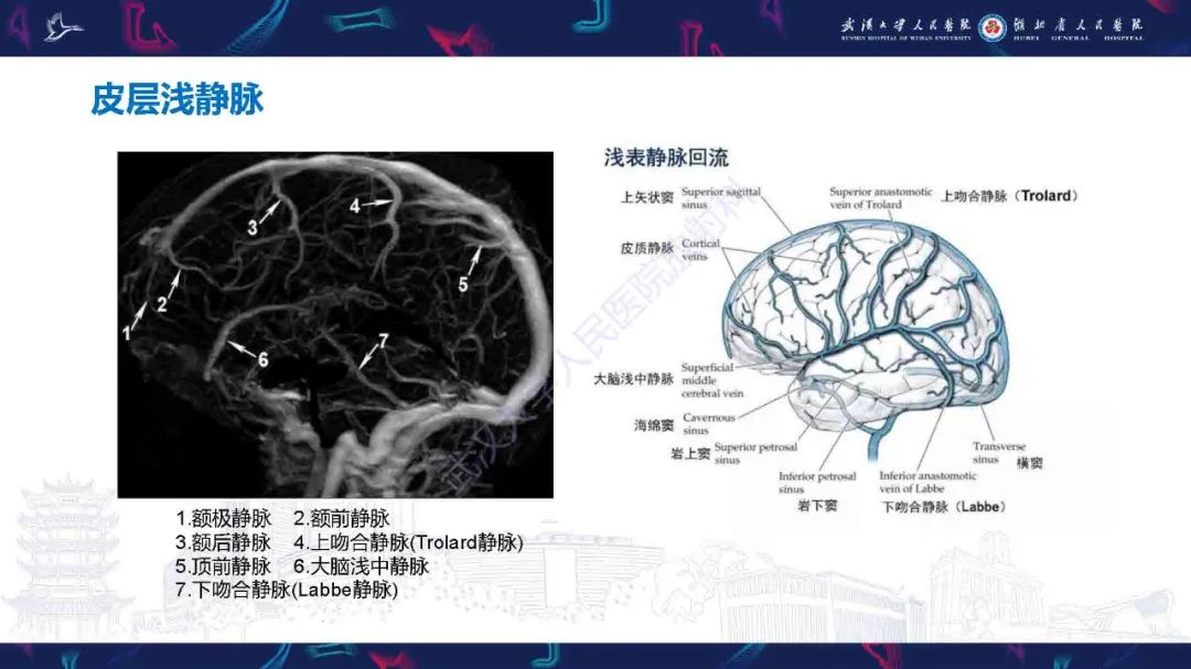 影像PPT - 【PPT】儿童脑静脉病变影像诊断-14