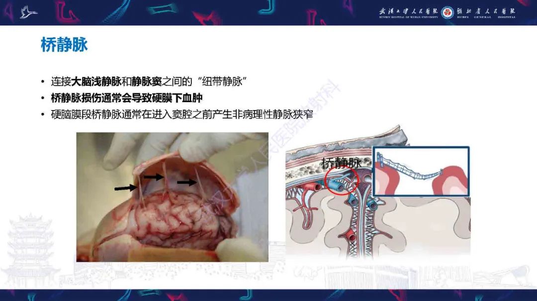 影像PPT - 【PPT】儿童脑静脉病变影像诊断-17