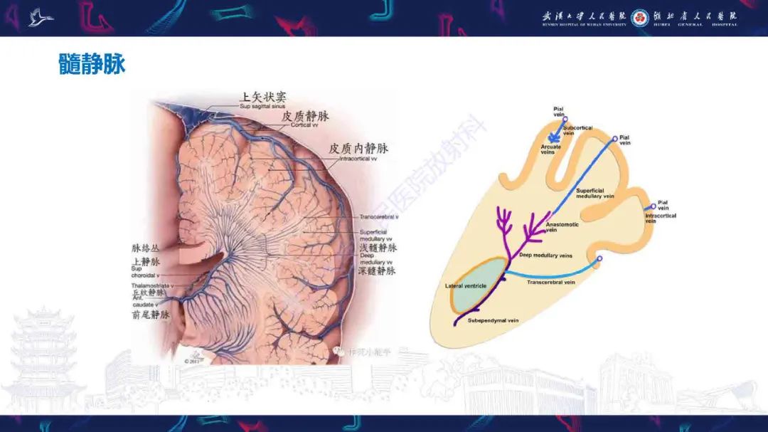 影像PPT - 【PPT】儿童脑静脉病变影像诊断-19