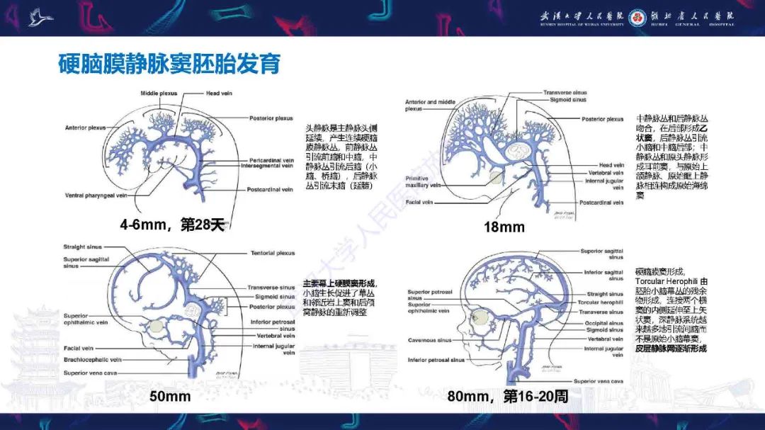 影像PPT - 【PPT】儿童脑静脉病变影像诊断-24