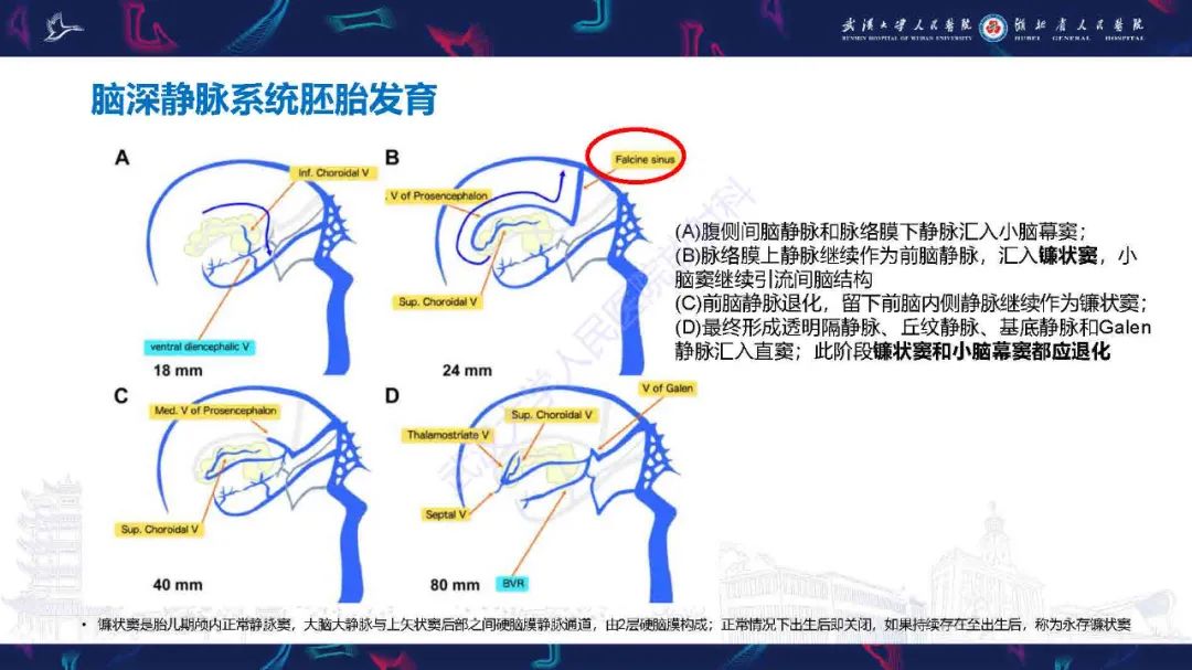 影像PPT - 【PPT】儿童脑静脉病变影像诊断-25