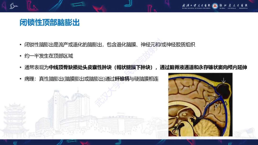 影像PPT - 【PPT】儿童脑静脉病变影像诊断-34