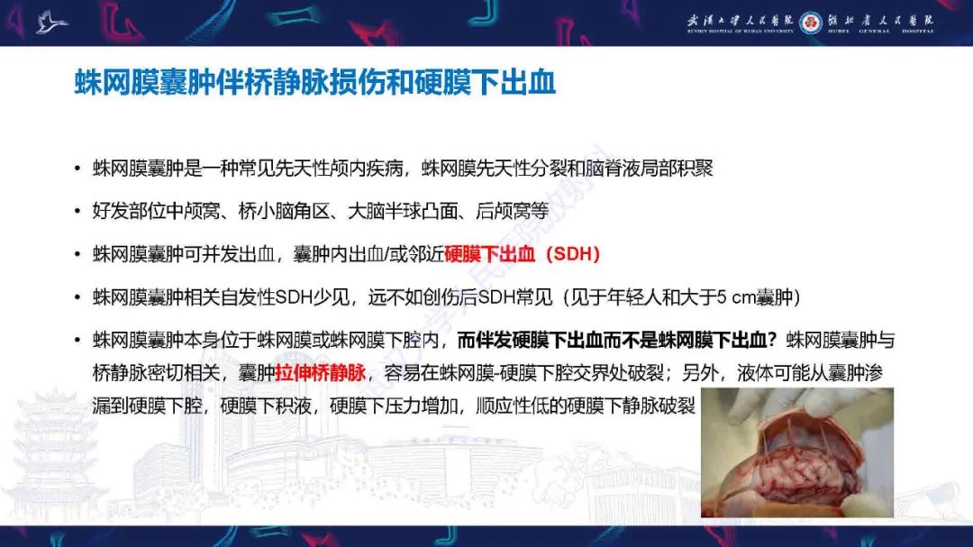 影像PPT - 【PPT】儿童脑静脉病变影像诊断-40