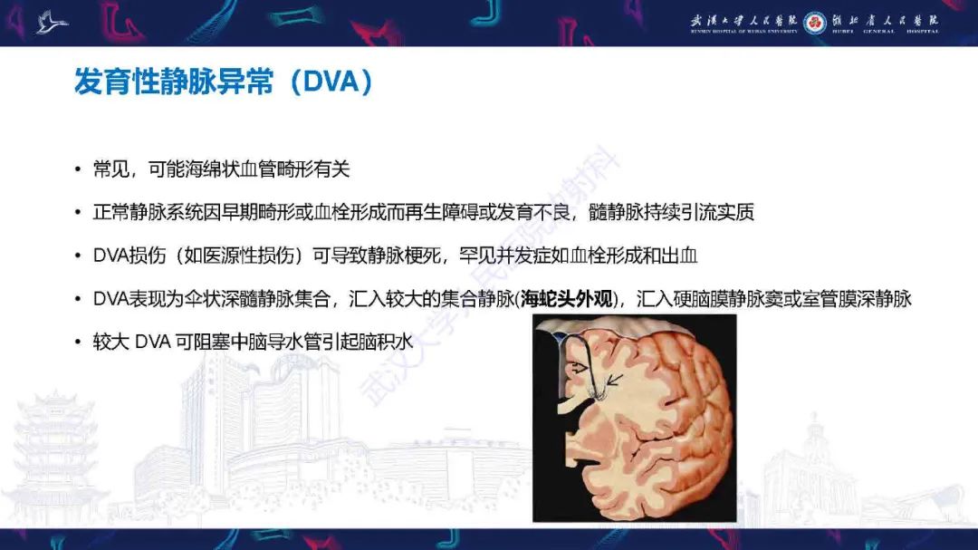 影像PPT - 【PPT】儿童脑静脉病变影像诊断-45