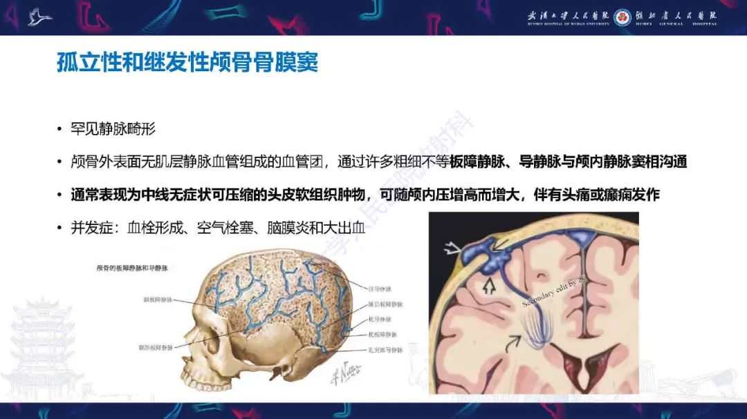 影像PPT - 【PPT】儿童脑静脉病变影像诊断-49