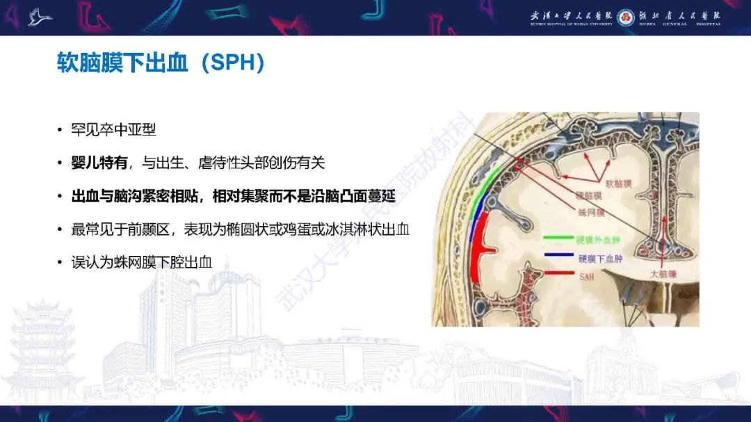 影像PPT - 【PPT】儿童脑静脉病变影像诊断-64