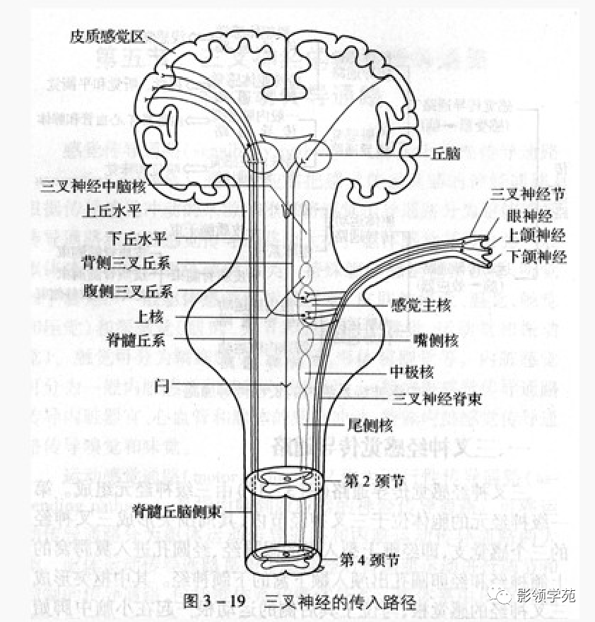 影像PPT - 三叉神经解剖及常见疾病MR表现-3
