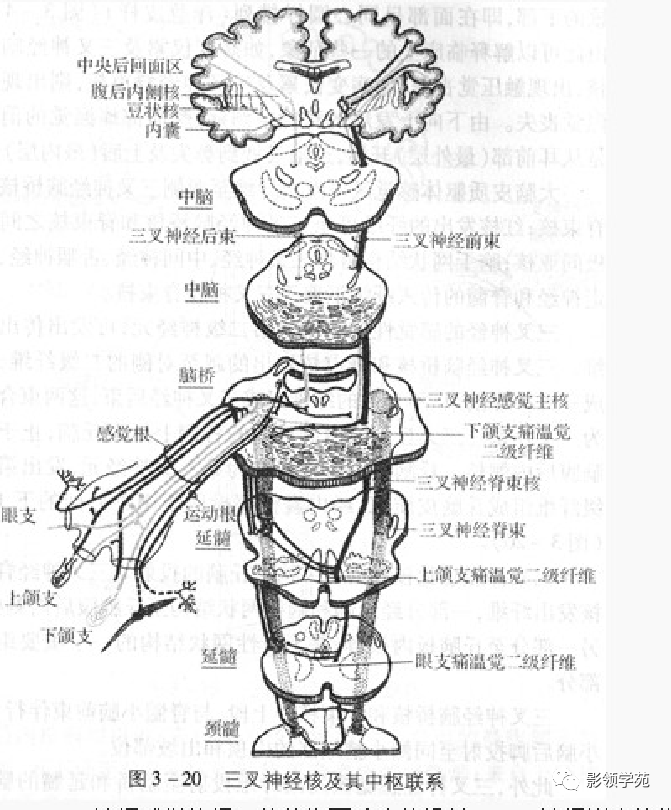 影像PPT - 三叉神经解剖及常见疾病MR表现-4