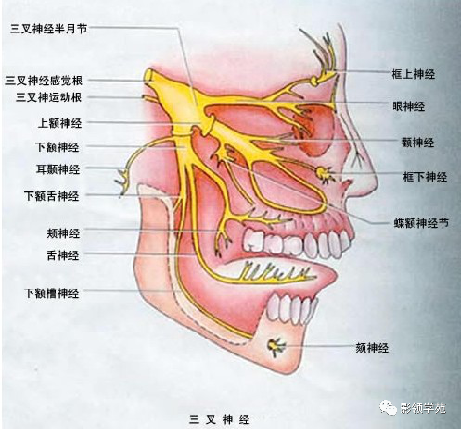 影像PPT - 三叉神经解剖及常见疾病MR表现-5