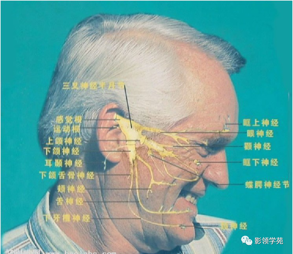 影像PPT - 三叉神经解剖及常见疾病MR表现-6