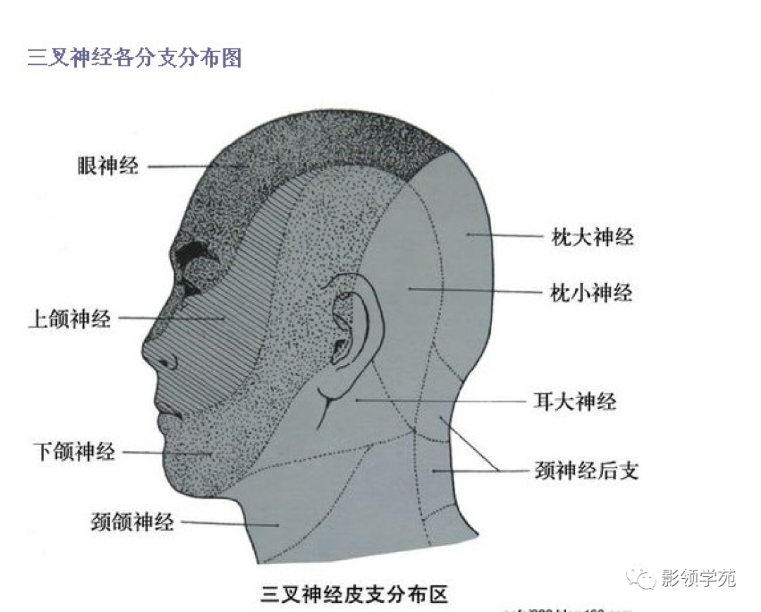 影像PPT - 三叉神经解剖及常见疾病MR表现-8