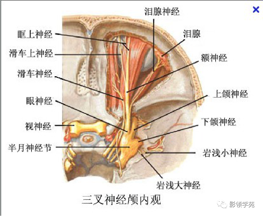 影像PPT - 三叉神经解剖及常见疾病MR表现-18