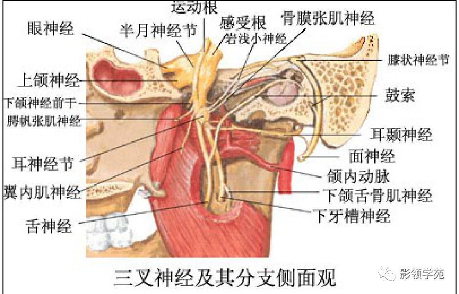 影像PPT - 三叉神经解剖及常见疾病MR表现-19