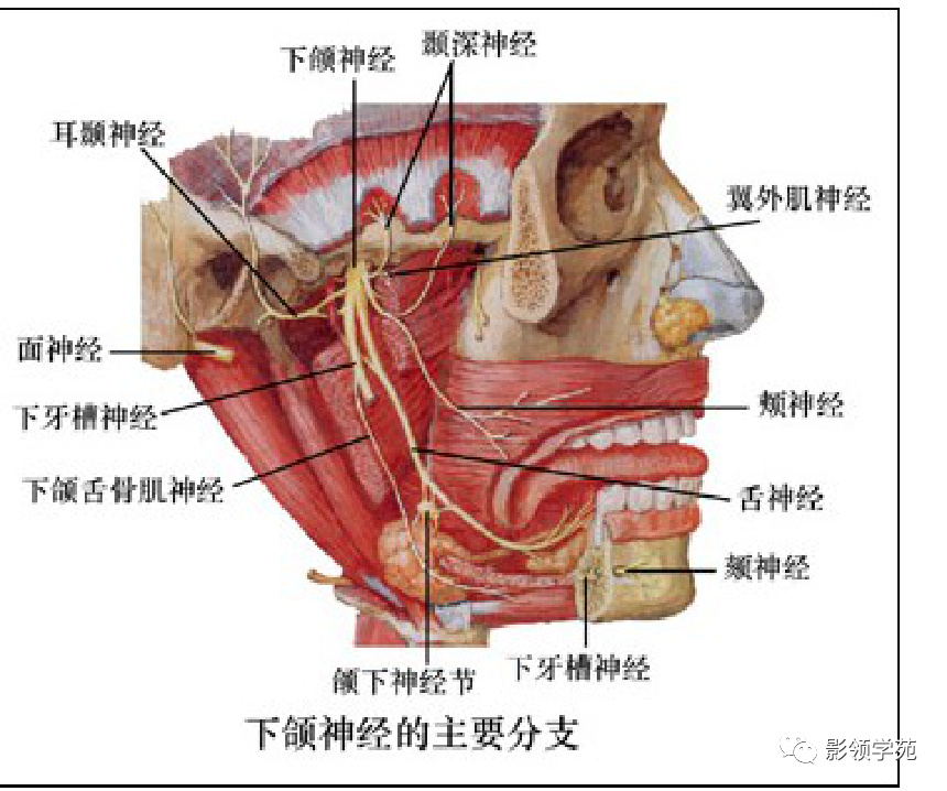 影像PPT - 三叉神经解剖及常见疾病MR表现-22
