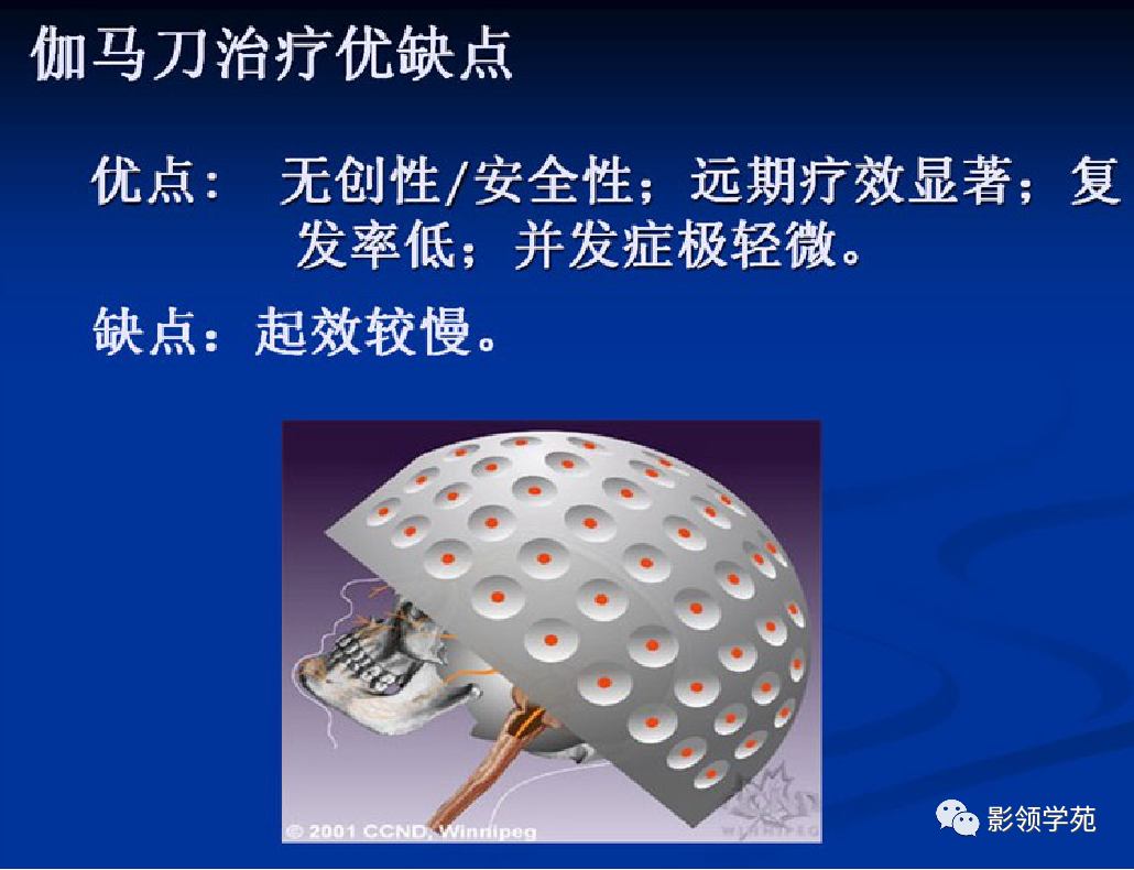 影像PPT - 三叉神经解剖及常见疾病MR表现-60