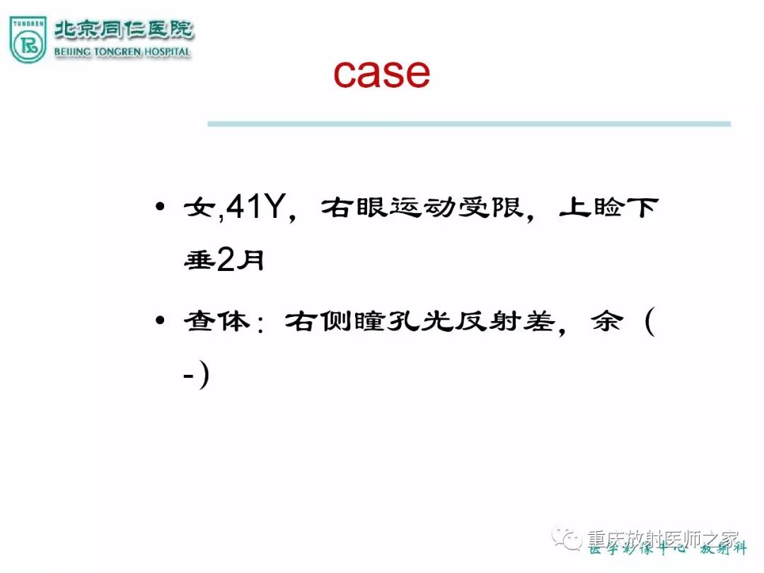 影像PPT - 【PPT】咽喉部病变影像分析-73