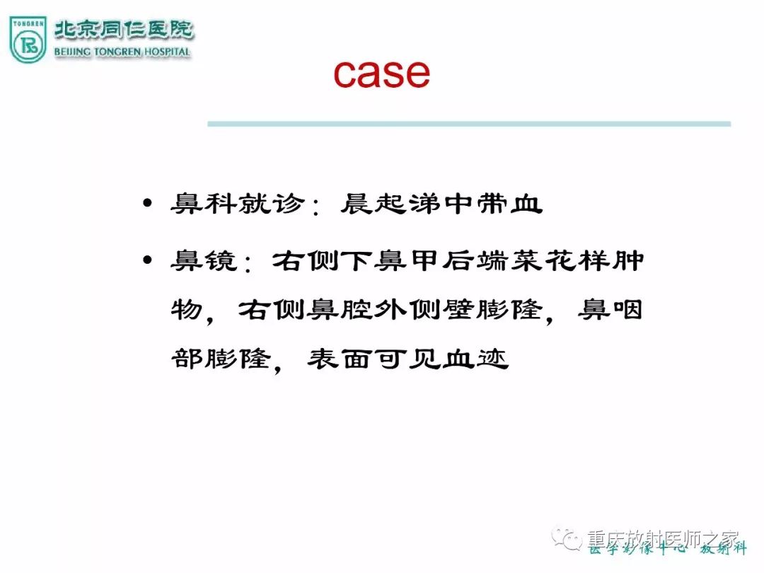 影像PPT - 【PPT】咽喉部病变影像分析-76