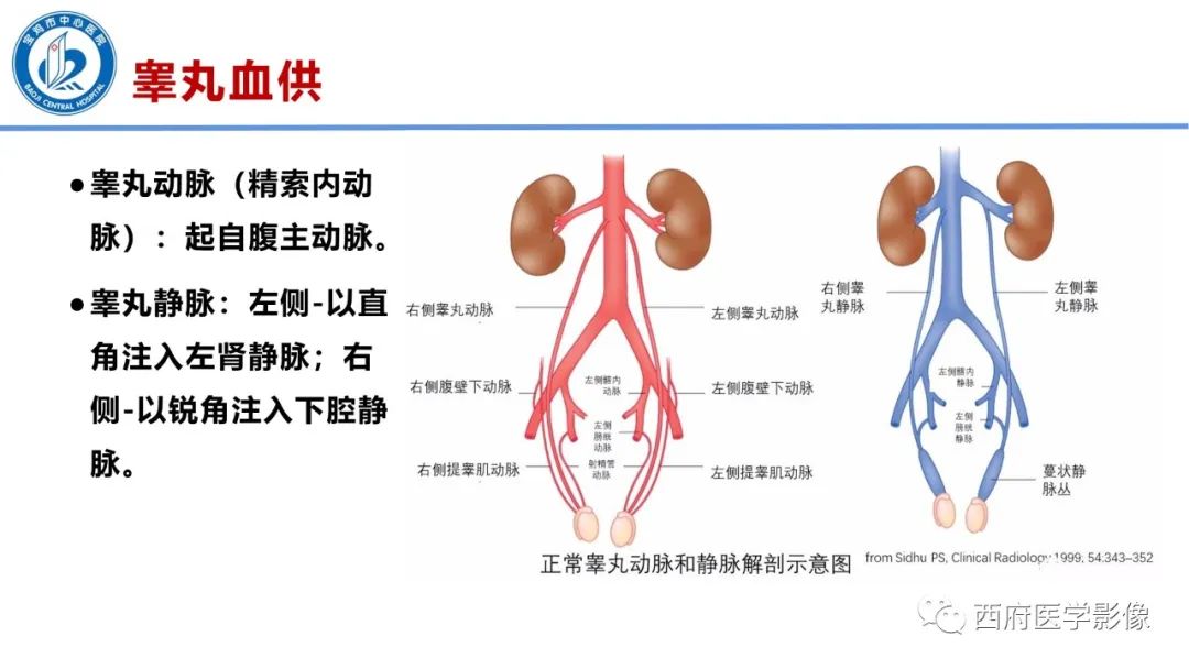 影像PPT - 【PPT】睾丸肿瘤及肿瘤样病变影像诊断与鉴别-4