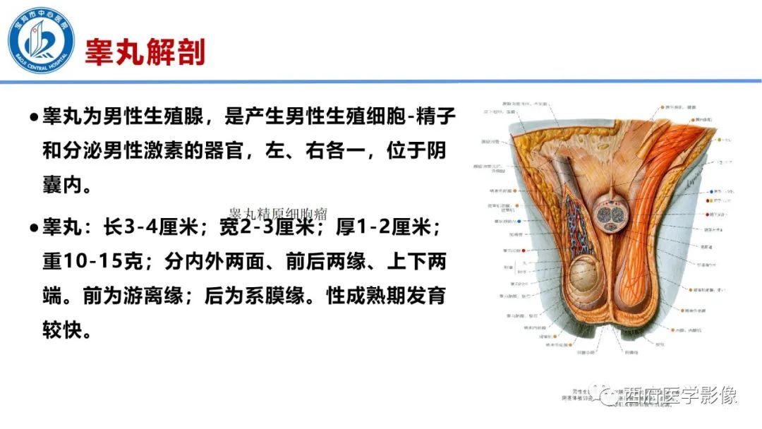 影像PPT - 【PPT】睾丸肿瘤及肿瘤样病变影像诊断与鉴别-2