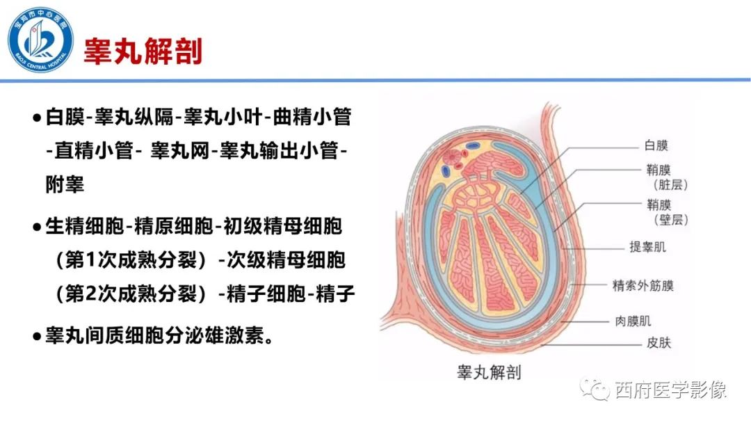 影像PPT - 【PPT】睾丸肿瘤及肿瘤样病变影像诊断与鉴别-3