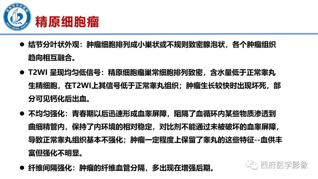 影像PPT - 【PPT】睾丸肿瘤及肿瘤样病变影像诊断与鉴别-14
