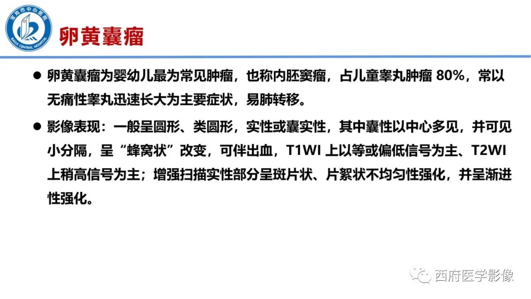 影像PPT - 【PPT】睾丸肿瘤及肿瘤样病变影像诊断与鉴别-19