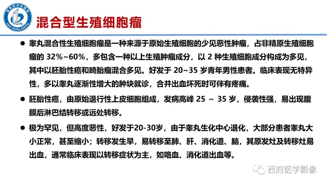 影像PPT - 【PPT】睾丸肿瘤及肿瘤样病变影像诊断与鉴别-21