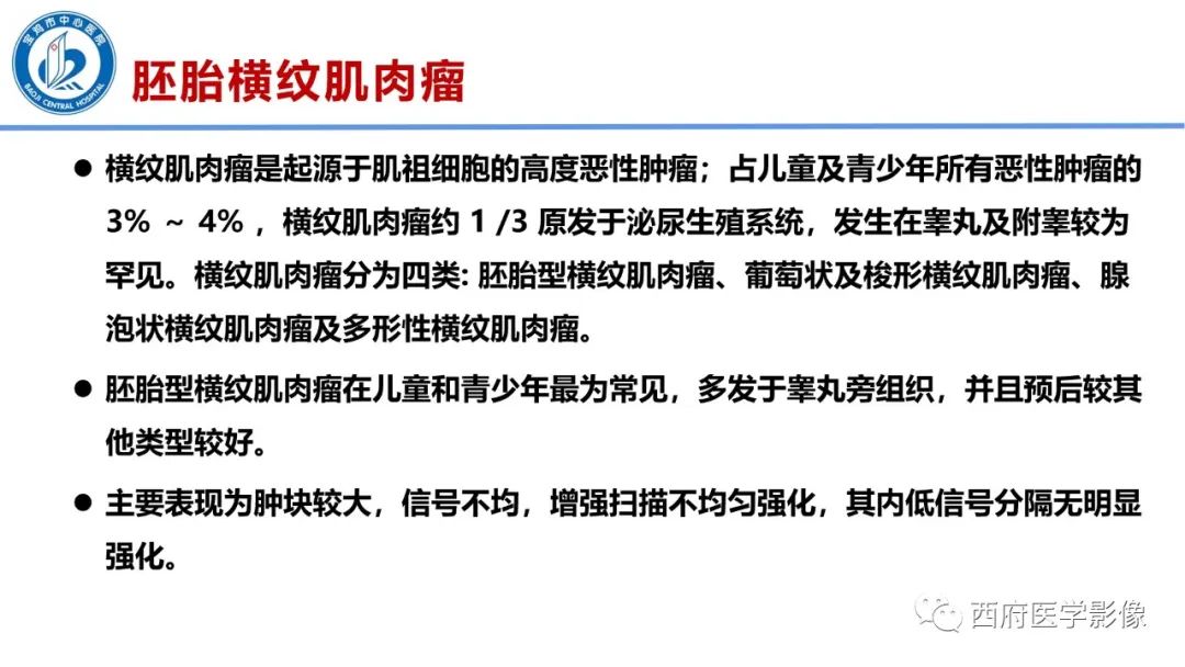 影像PPT - 【PPT】睾丸肿瘤及肿瘤样病变影像诊断与鉴别-29