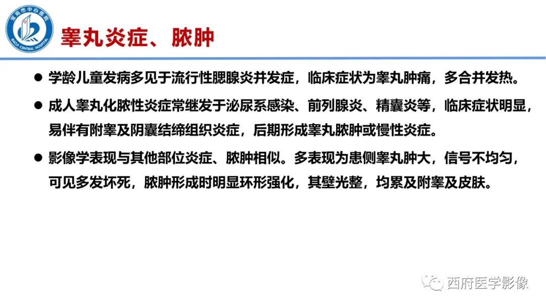 影像PPT - 【PPT】睾丸肿瘤及肿瘤样病变影像诊断与鉴别-36